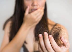 is alopecia an autoimmune disease