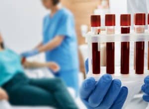 BLOOD TESTS FOR INFLAMMATION